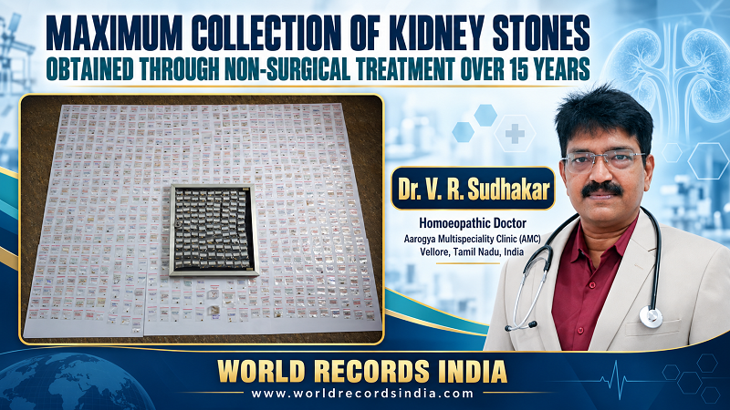  MAXIMUM COLLECTION OF KIDNEY STONES OBTAINED THROUGH NON-SURGICAL TREATMENT OVER 15 YEARS